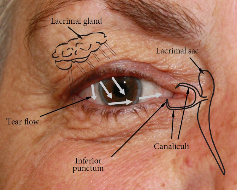 Socket anatomy - New Zealand Prosthetic Eye Service