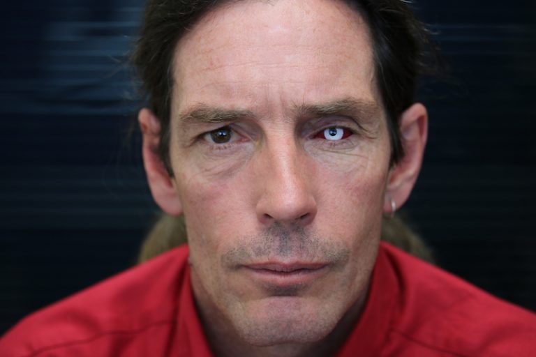 Novelty Eyes New Zealand Prosthetic Eye Service